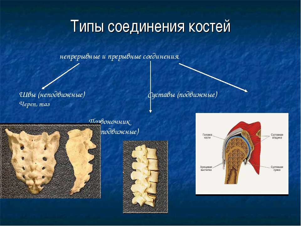 Прерывное соединение кости. Прерывные и непрерывные соединения костей. Соединение костей скелета непрерывные. Типы соединения костей. Типы соединения костей непрерывные прерывные.